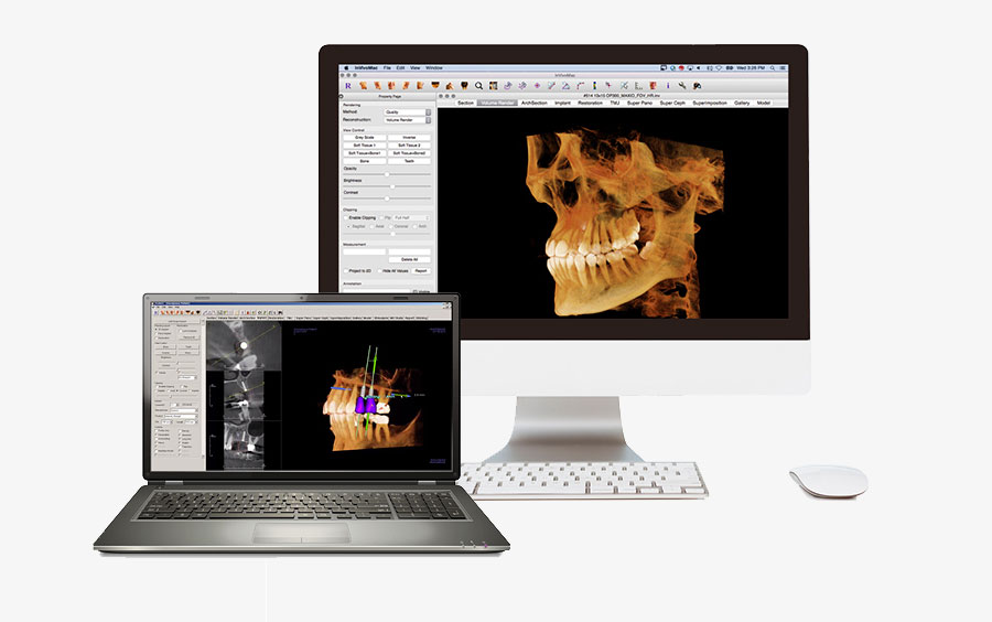 3D scan tanden gebit Turnhout De Zutter