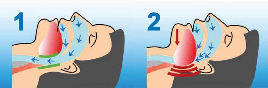 orthodontist Turnhout De Zutter